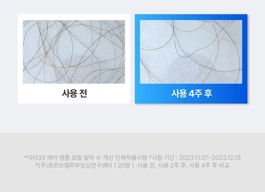 [올영단독/더블기획] 씨퓨리 닥터33 탈모앰플 20ml + 20ml 더블 기획세트 상세페이지 27